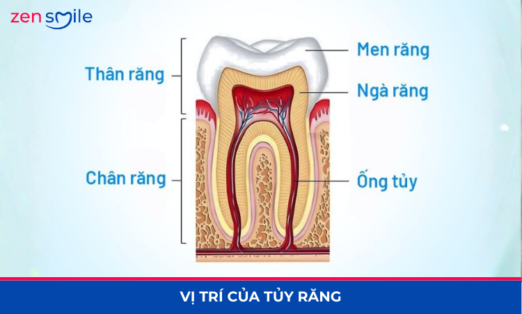 Điều trị tuỷ 1 lần hẹn (1 buổi) — ảnh 2