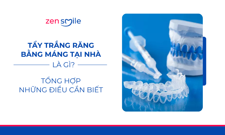 Tẩy trắng răng tại nhà — ảnh 7