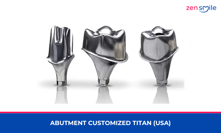 Abutment Customized Titan (USA) — ảnh 2