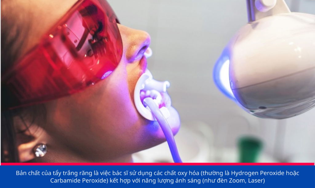 Tẩy trắng răng Nhật Bản — ảnh 3