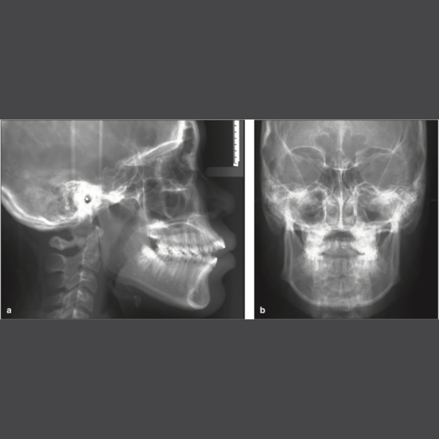 Chụp 2D Cephalometric — ảnh 5