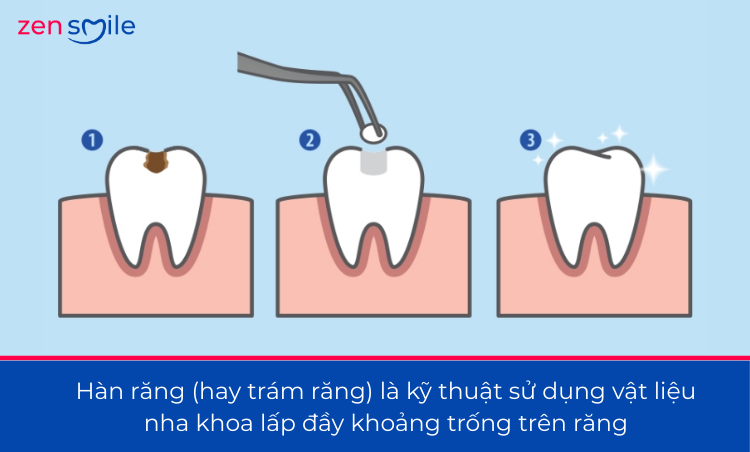Hàn tạm — ảnh 2