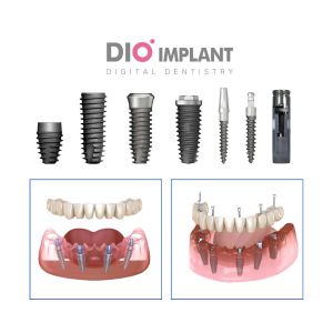 Implant All-on DIO Korea