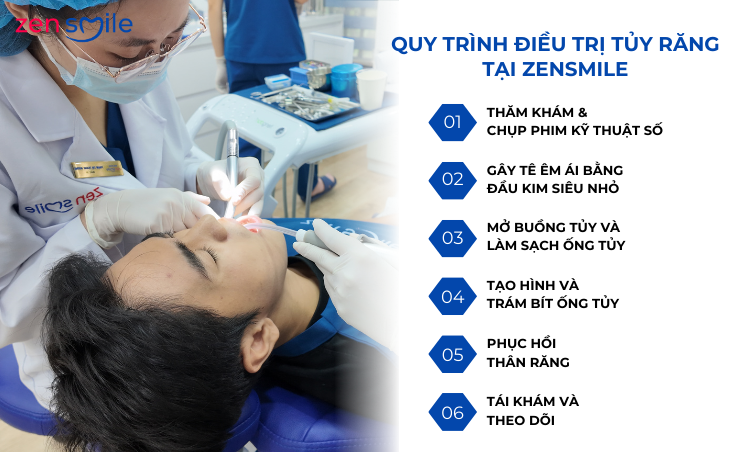 Điều trị tuỷ răng sữa — ảnh 4