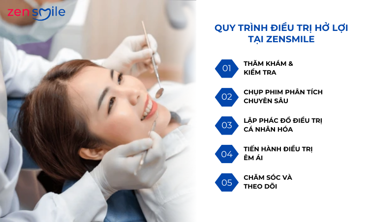 Điều trị hở lợi độ 1-3 — ảnh 5