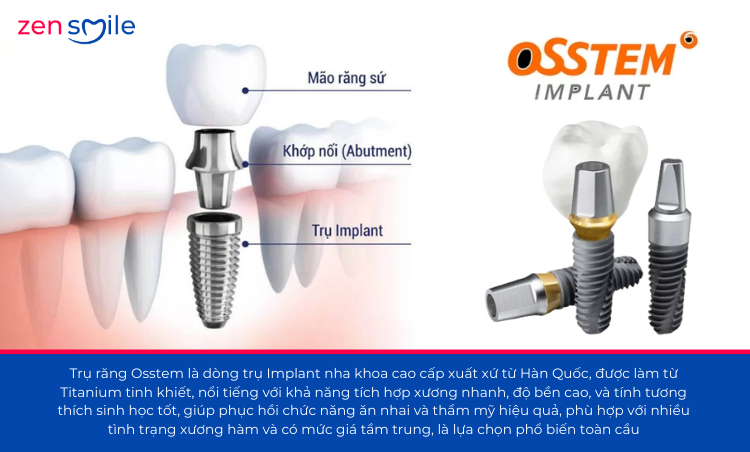 Implant All-on Osstem — ảnh 7