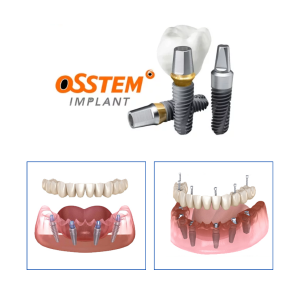 Implant All-on Osstem
