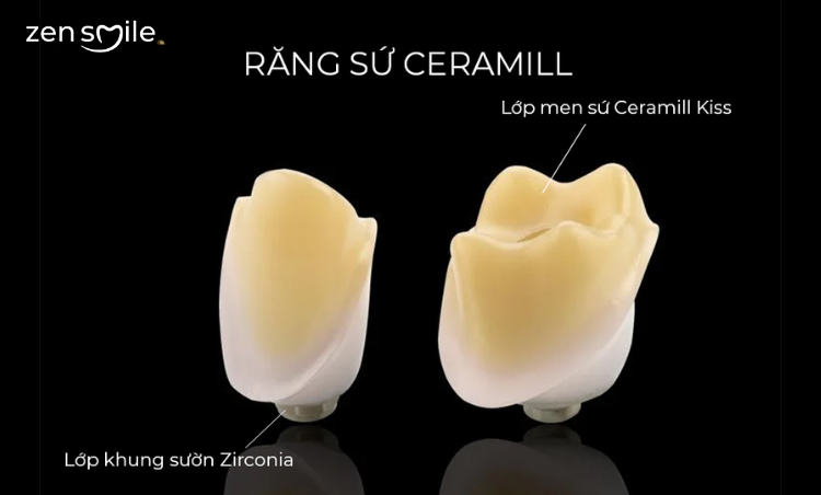 Răng sứ Ceramill — ảnh 4
