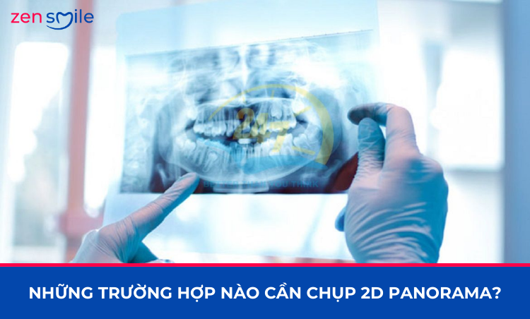 Chụp 2D Panorama — ảnh 7