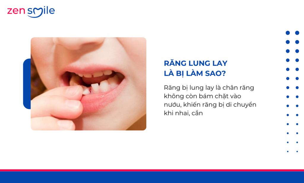 Nhổ răng lung lay — ảnh 6