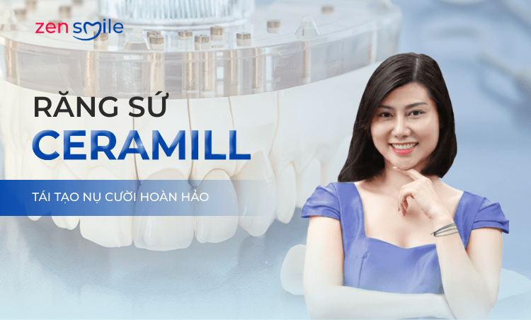Răng sứ Ceramill — ảnh 5