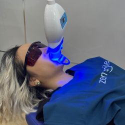 Tẩy trắng răng Nhật Bản